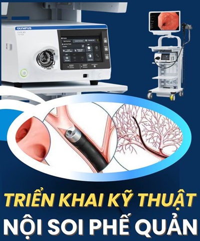 Bệnh viện Trường Đại học Y Dược Cần Thơ nâng cao chất lượng điều trị hô hấp bằng kỹ thuật nội soi phế quản