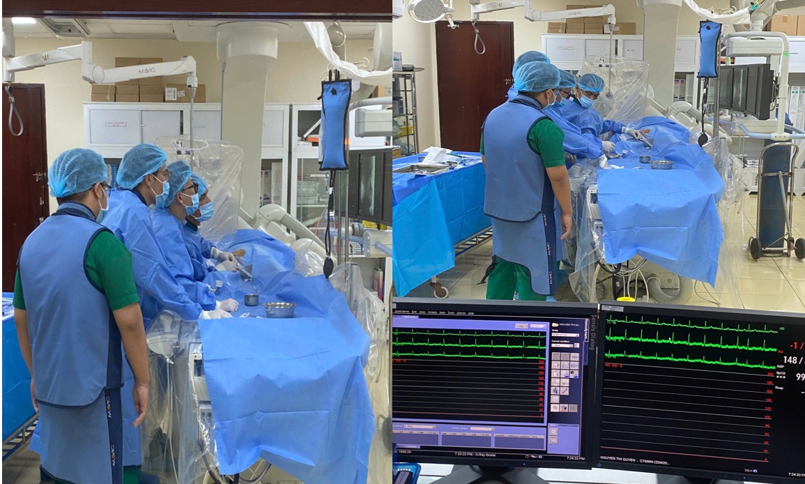 Bệnh viện Trường Đại học Y Dược Cần Thơ điều trị hẹp động mạch cảnh phương pháp đặt stent