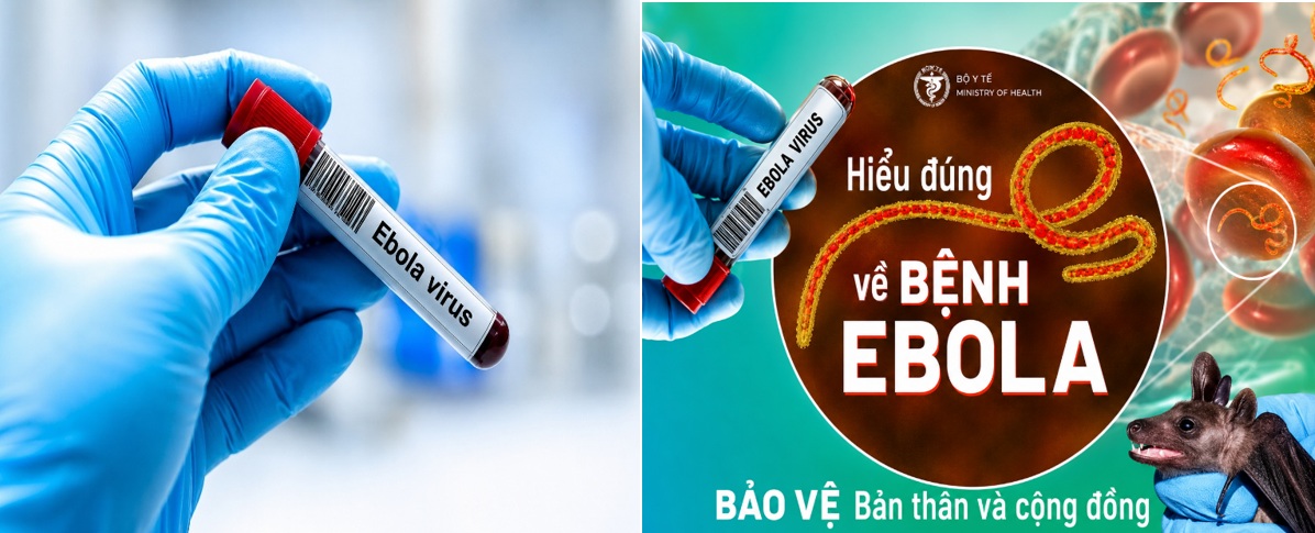 Bệnh viện Trường Đại học Y Dược Cần Thơ - Ebola: Nhận biết sớm - phòng lây nhiễm đúng cách