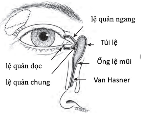 Phẫu thuật thành công nối thông lệ quản kết hợp khâu mi cho người bệnh chấn thương mắt