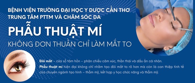 "Phẫu thuật mí" KHÔNG ĐƠN THUẦN CHỈ LÀM MẮT TO